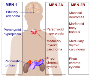 Multiple_endocrine_neoplasia